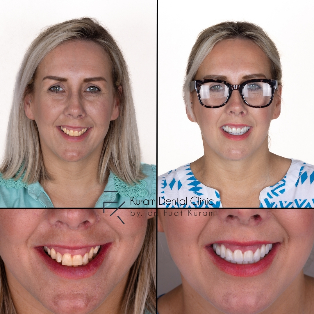 Antalya Best Dental Clinic