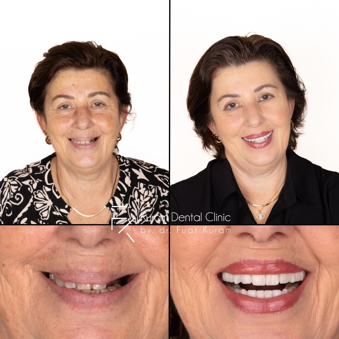 Antalya Dental Clinic
