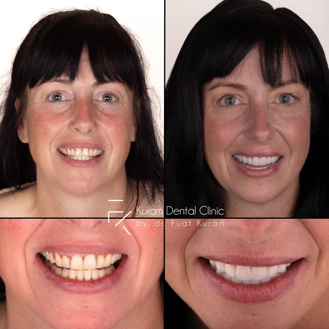 Turkey Dental Clinic