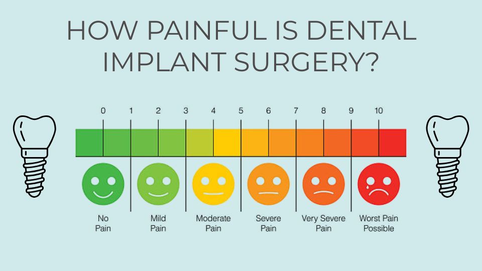 How Painful is Dental Implant Surgery? What to Expect