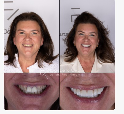 Antalya Best Dental Clinic