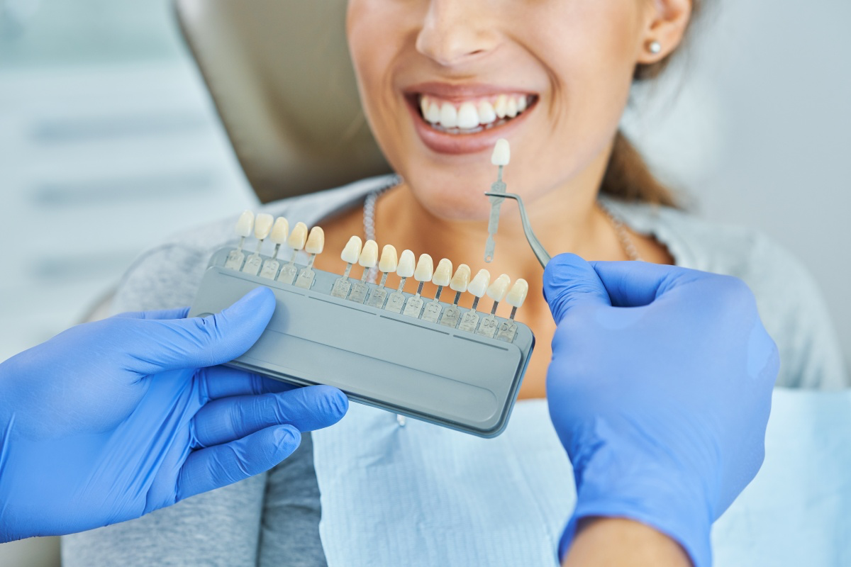 E-MAX Veneer Procedure E-MAX Veneer Procedure