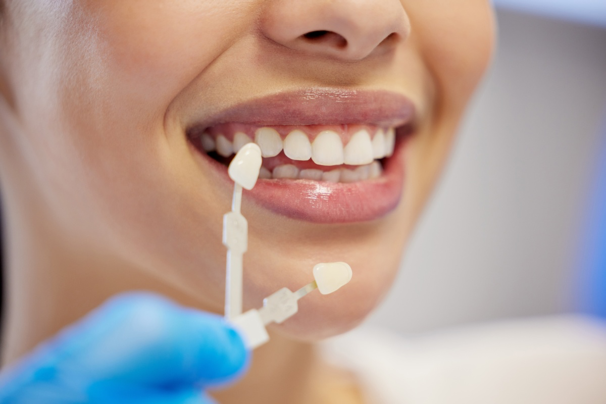 Zirconium teeth design Zirconium teeth design